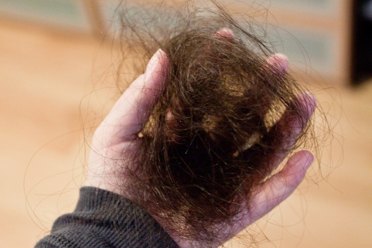 Causas de queda de cabelo em mulheres após os 40