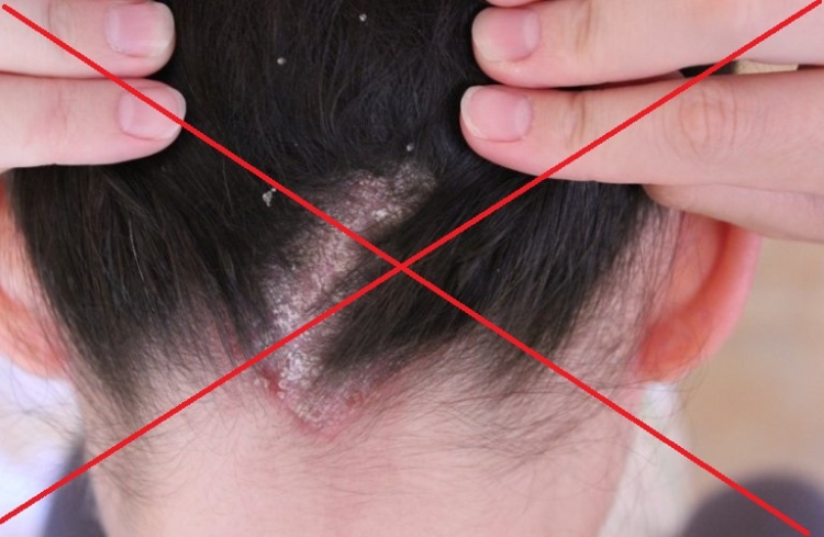 Protegendo o cabelo o que é isso