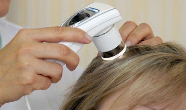 Queda de cabelo por estresse