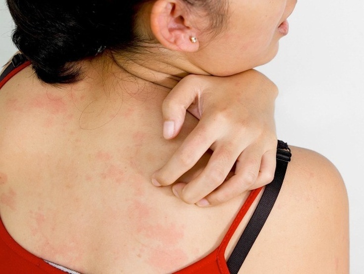 Selentsin avaliações de médicos de tricologistas