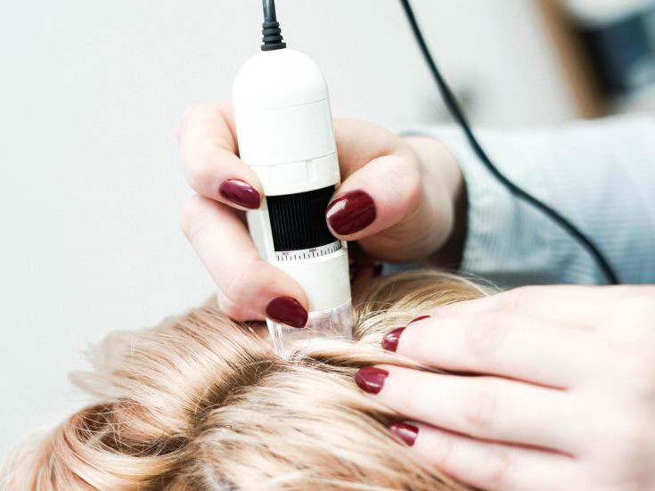 Terapia de ozônio para o couro cabeludo