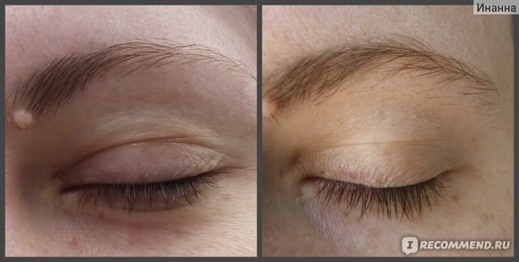 Óleo essencial de lavanda para cabelo