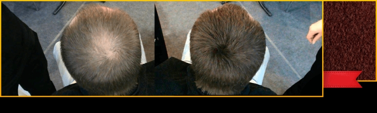 Os 5 melhores espessantes de cabelo