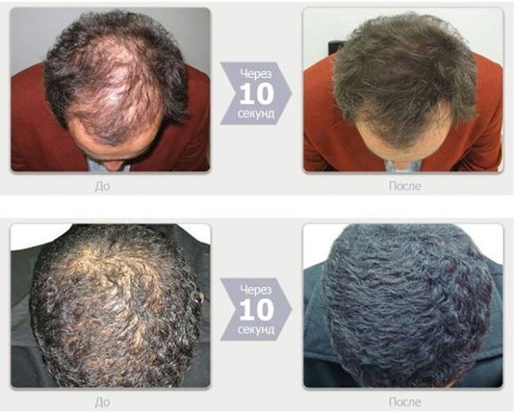 Os 5 melhores espessantes de cabelo