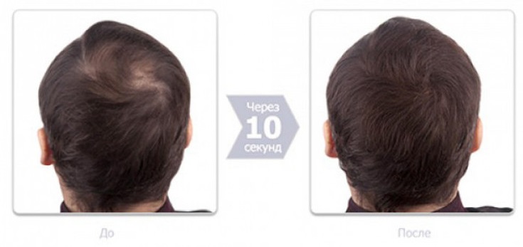 Os 5 melhores espessantes de cabelo