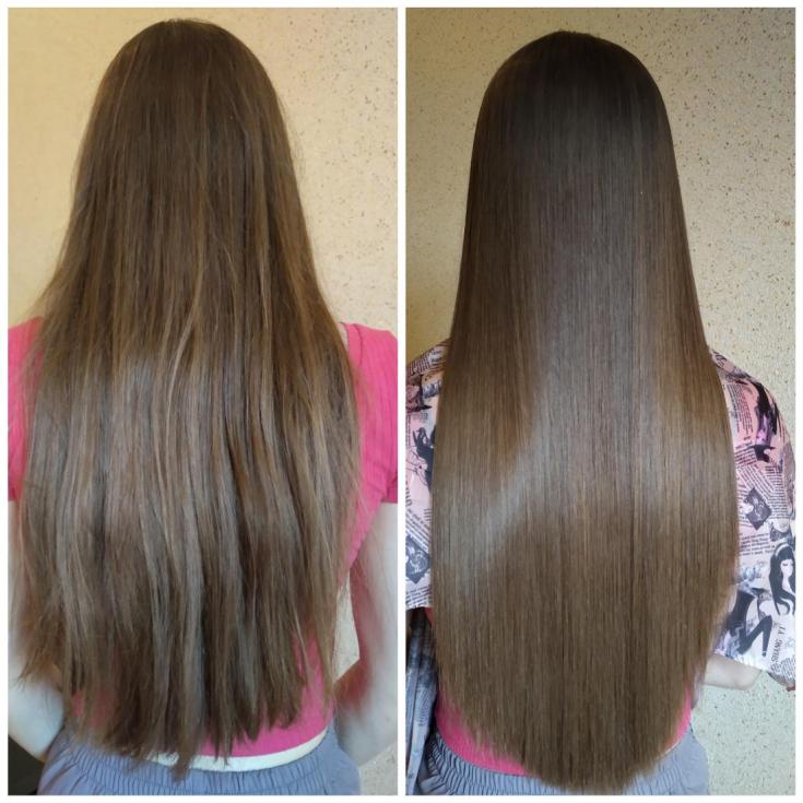 Reconstrução capilar