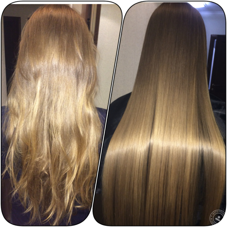 Reconstrução capilar