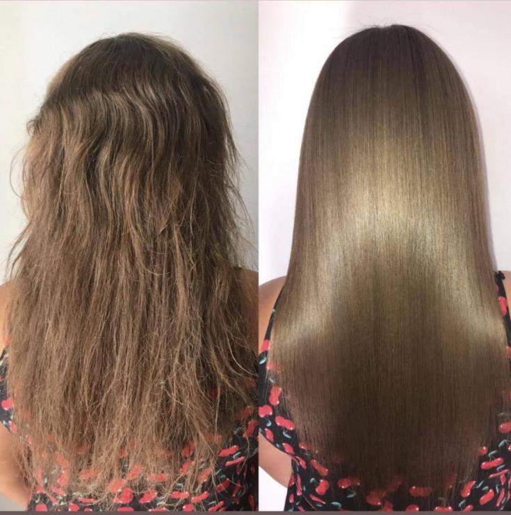 Reconstrução capilar