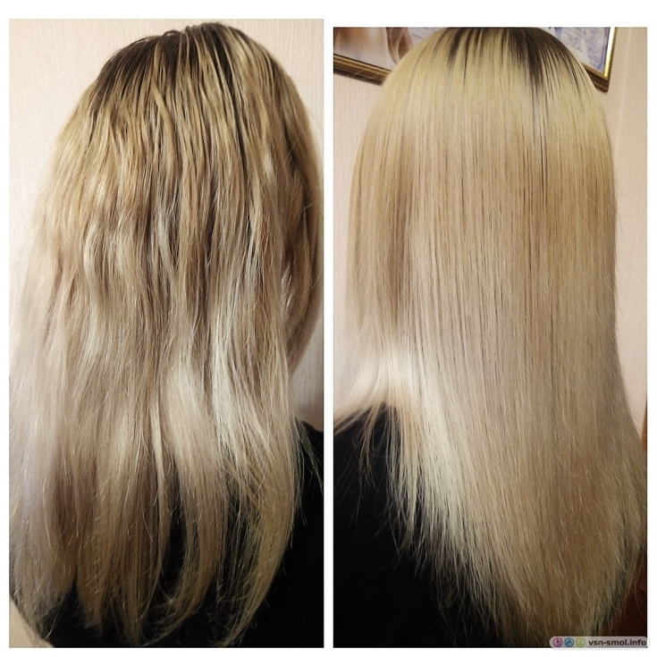 Reconstrução capilar