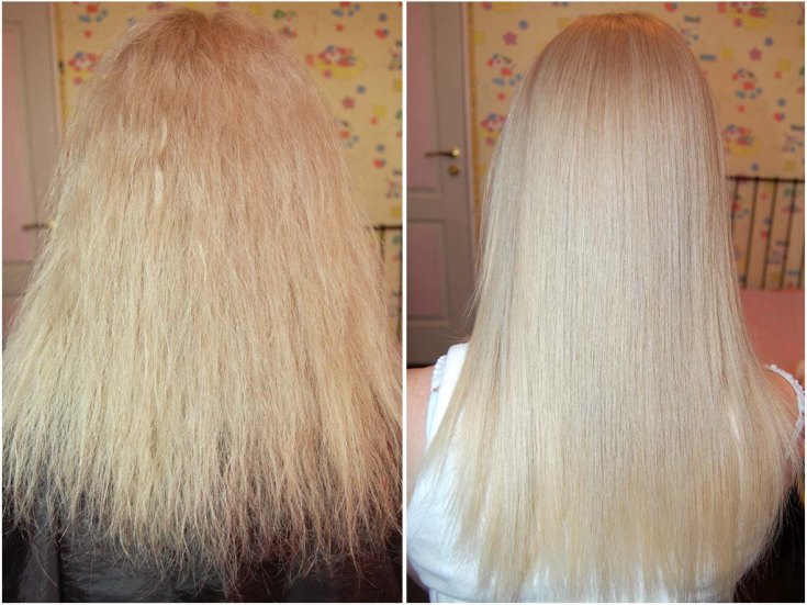 Reconstrução capilar