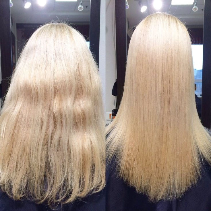 Reconstrução capilar