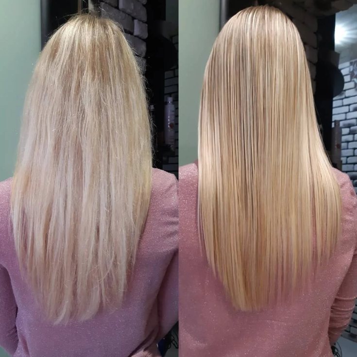 Reconstrução capilar