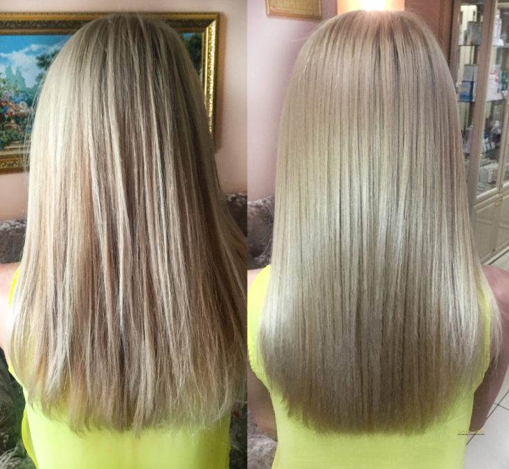 Reconstrução capilar