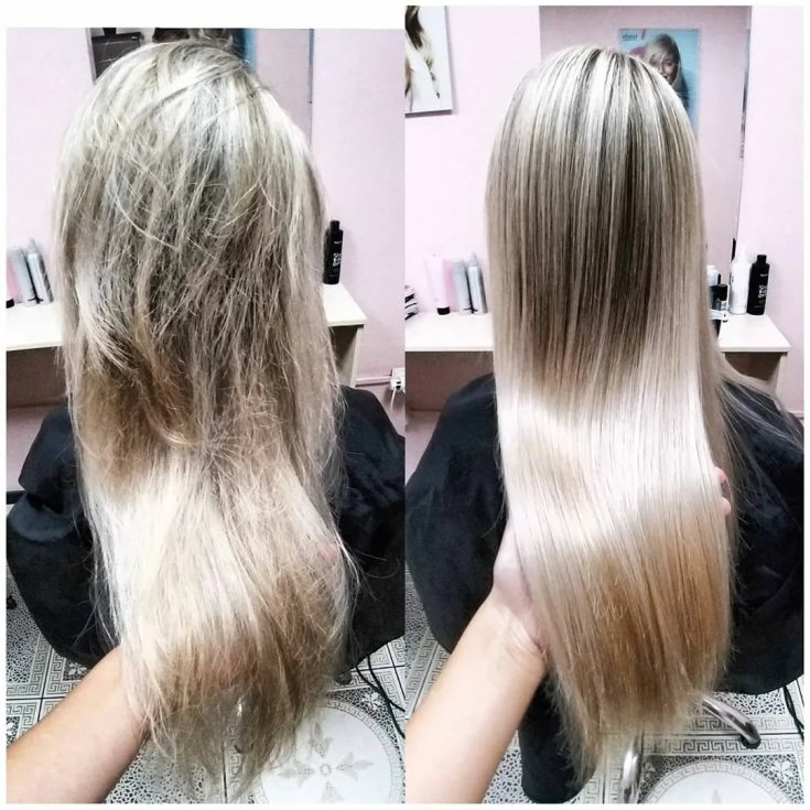 Reconstrução capilar