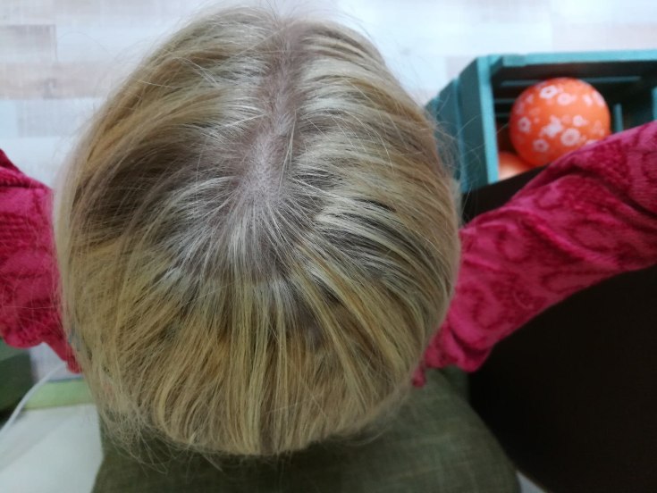 Como remover os verdes do cabelo após a tintura