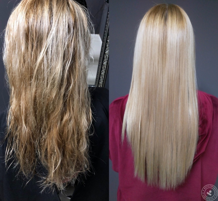 Reconstrução capilar